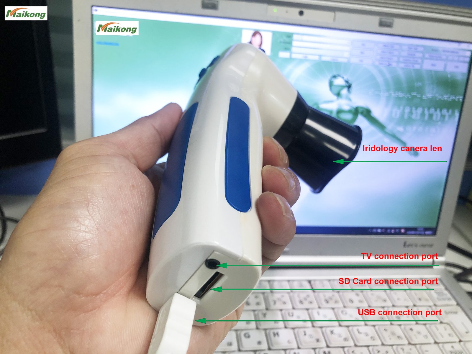 MasterFastSystem Iriscope