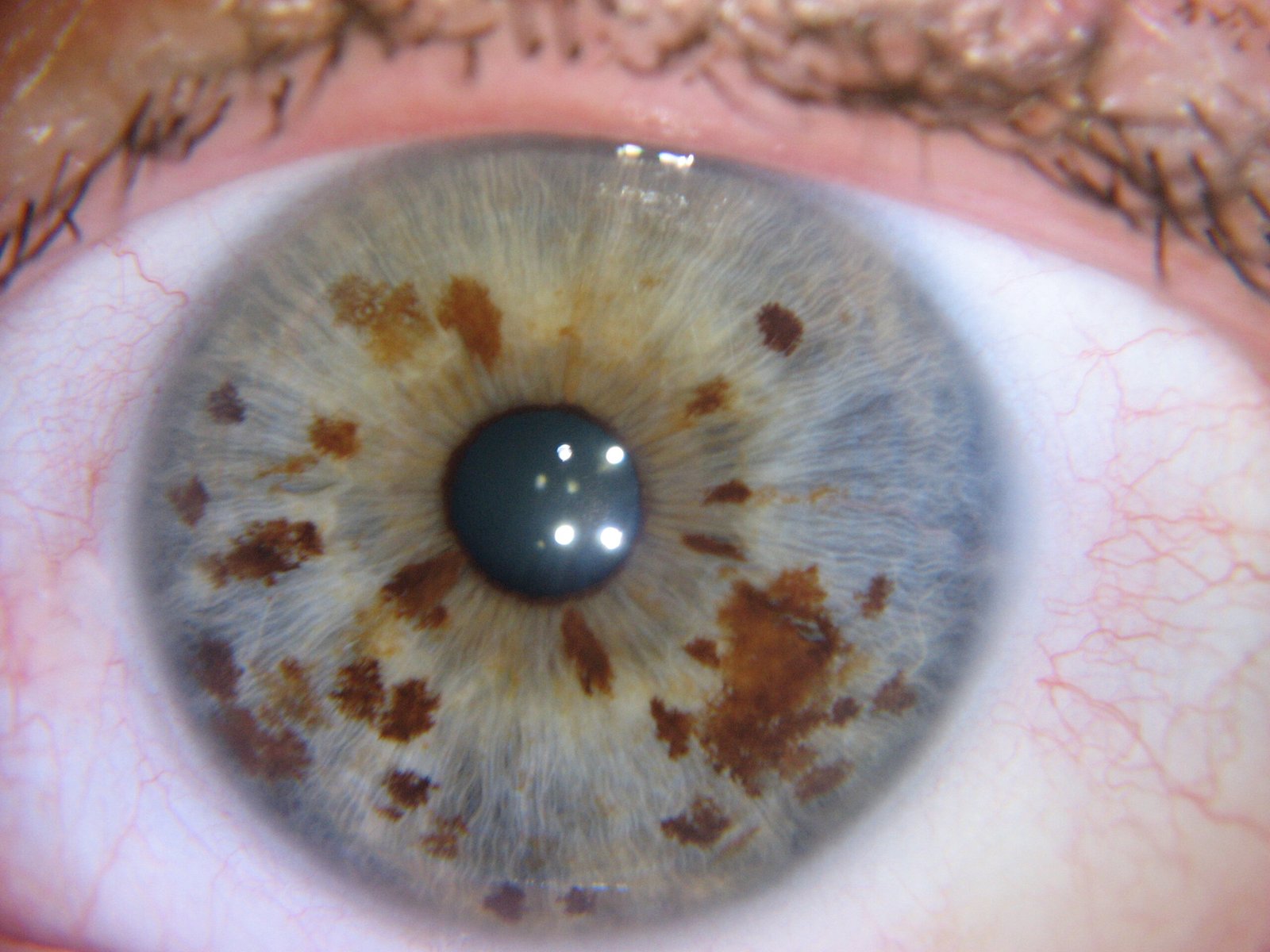 Close-up comparison of iris images showing different camera resolution quality levels