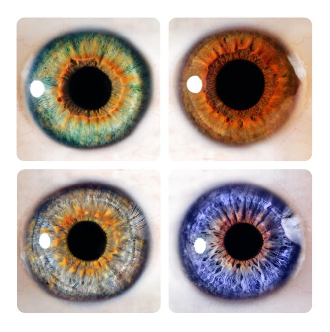 Three different iris colors showing constitutional variations