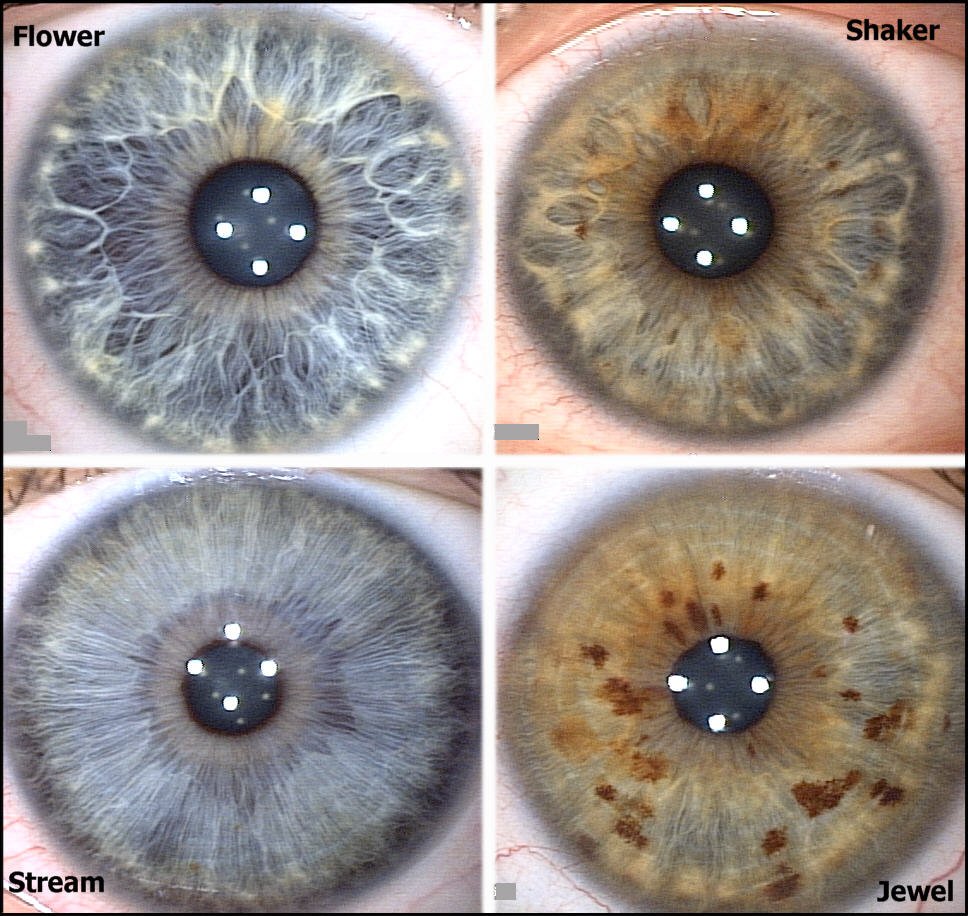 rayid iridology chart showing four main iris pattern types