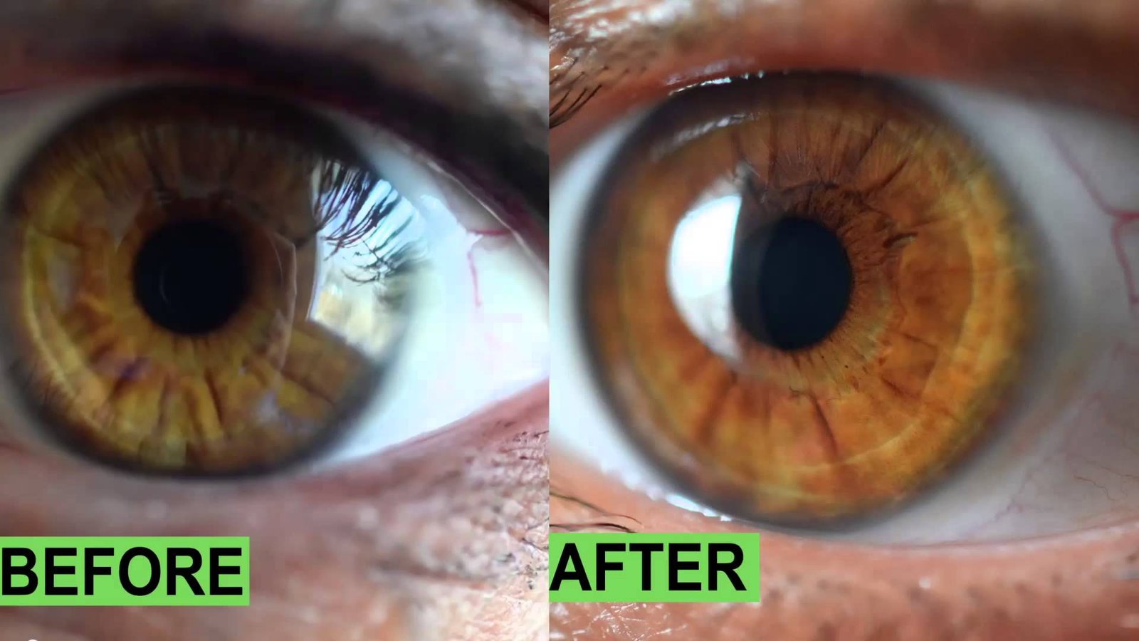 side-by-side iris comparison showing before and after