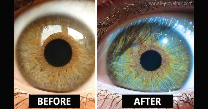 Side-by-side comparison of different iridology software interfaces
