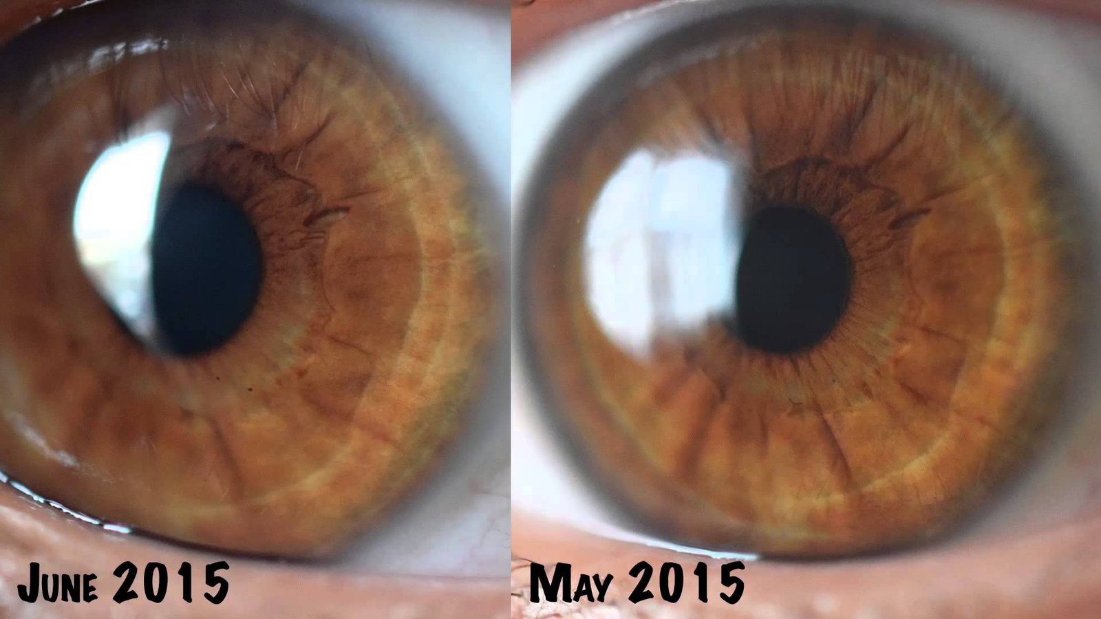 Before and after iris image enhancement comparison