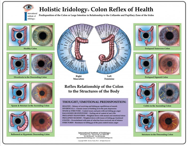 Iridology Amarillo TX 16 Comparison showing misaligned vs properly aligned chart overlay on iris image