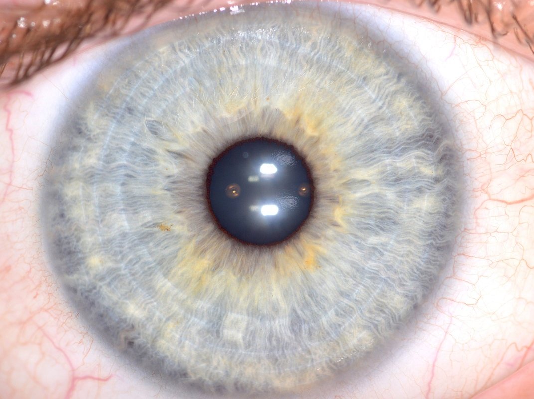 High-resolution iris image captured with pebble 9 camera