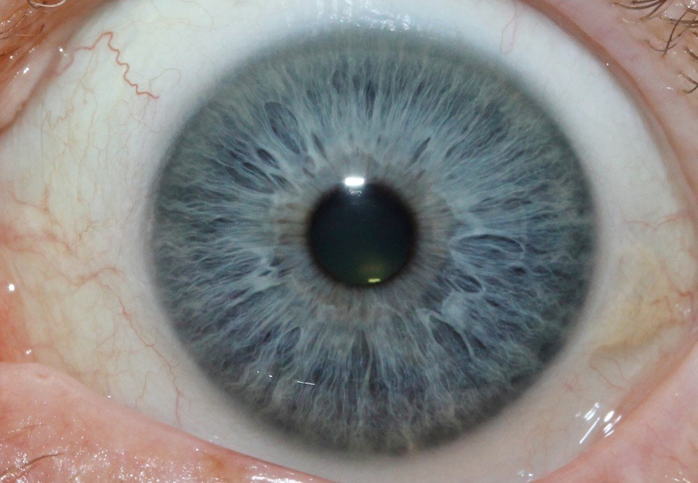 detailed iris close-up showing intricate patterns and textures