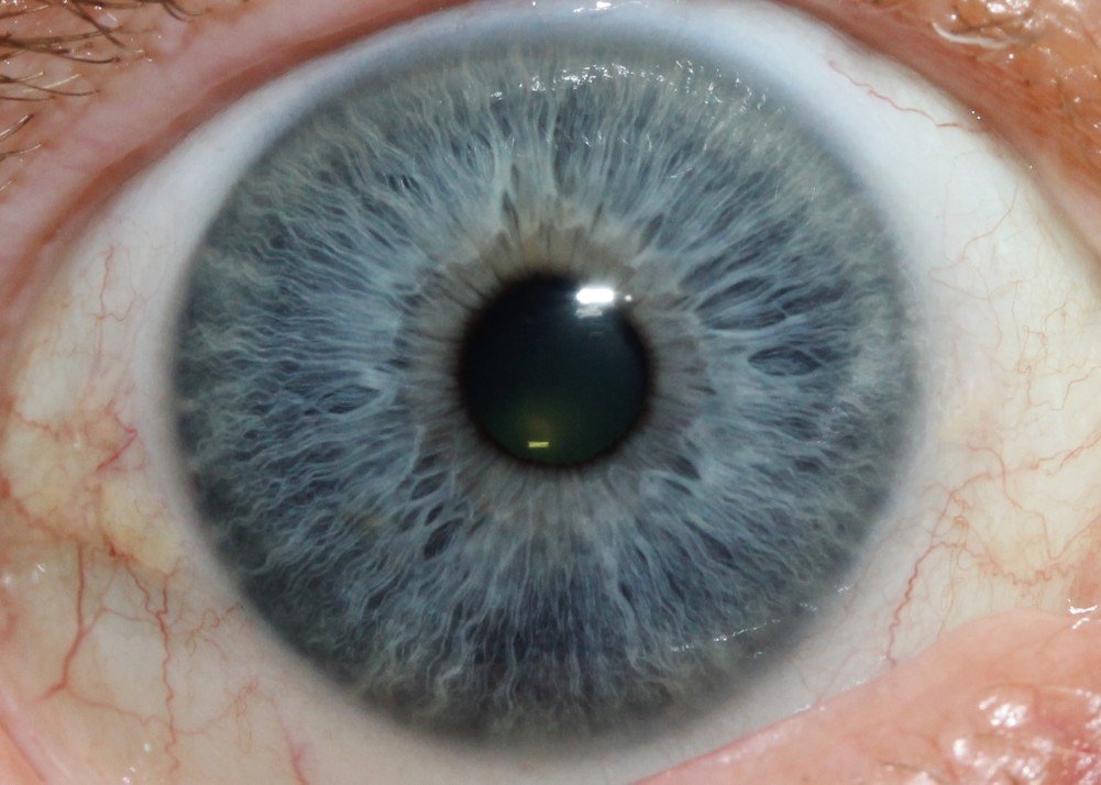 Professional iridology liver chart showing detailed iris zone mappings