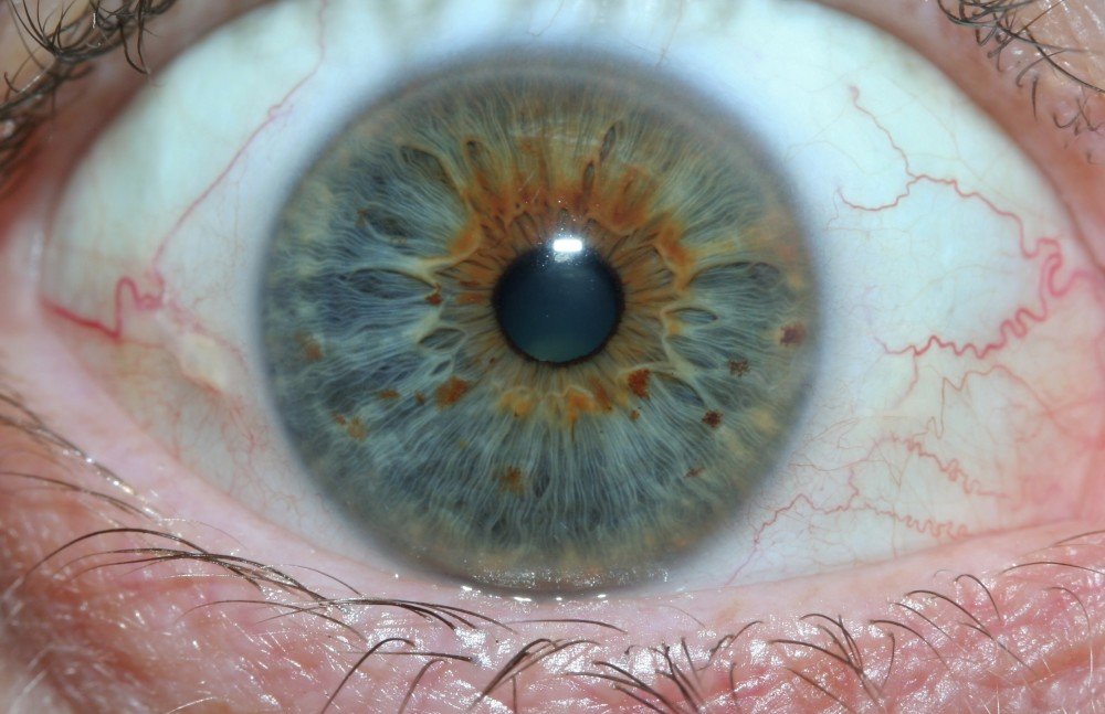 Professional iridology liver chart showing detailed iris zone mappings
