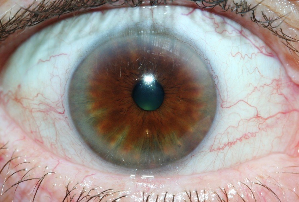 MAIKONG IRIDOLOGY