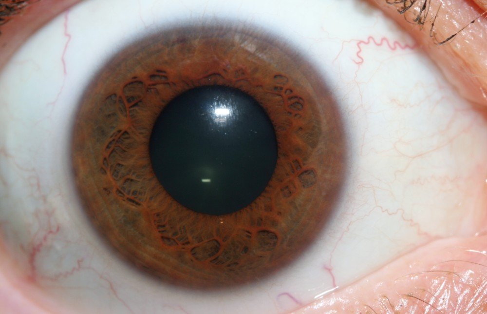MAIKONG IRIDOLOGY 