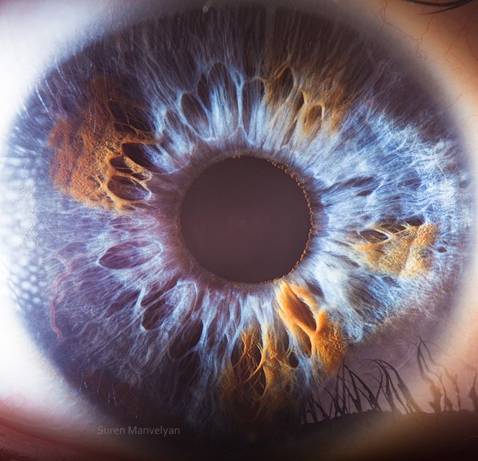 Practitioner using iridology camera to capture iris images during consultation