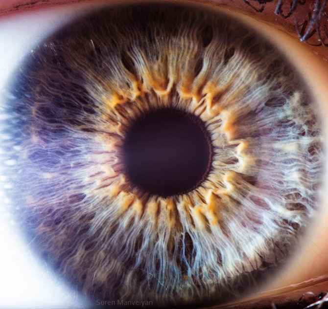 Practitioner using iridology camera to capture iris images during consultation