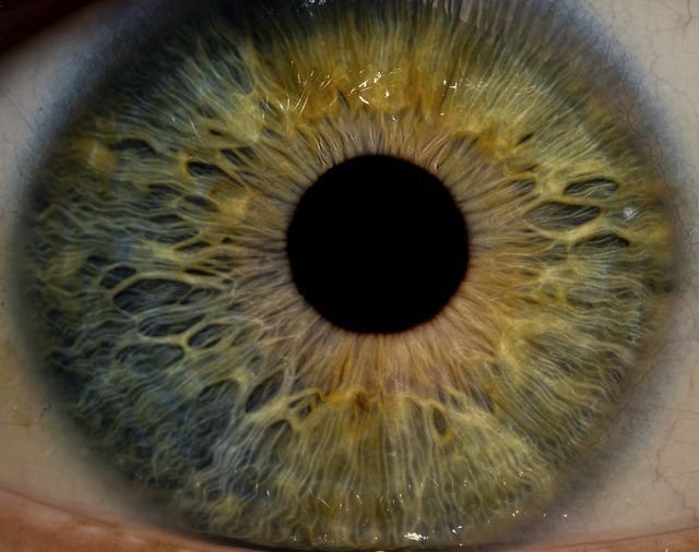 IRIDOLOGY 