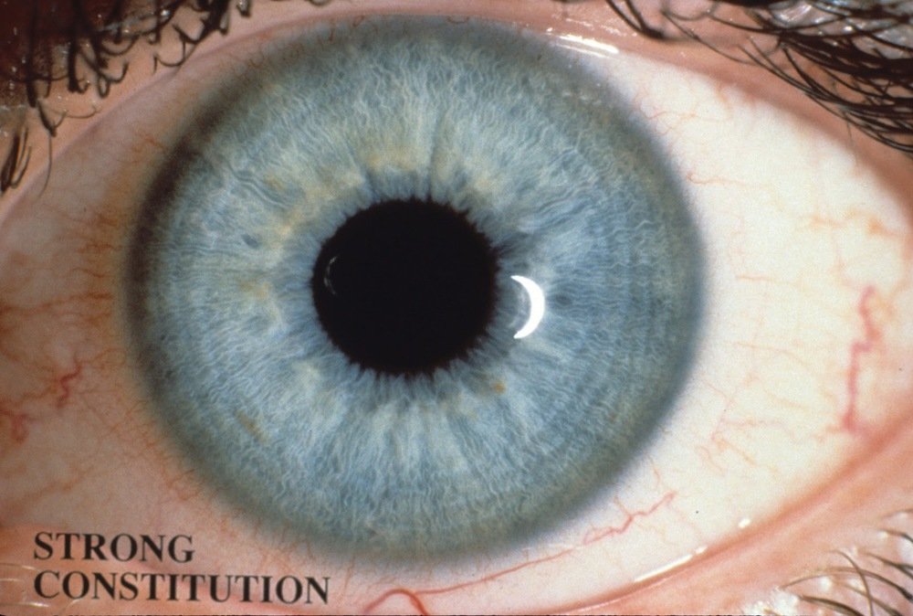 iris image quality comparison different lighting conditions