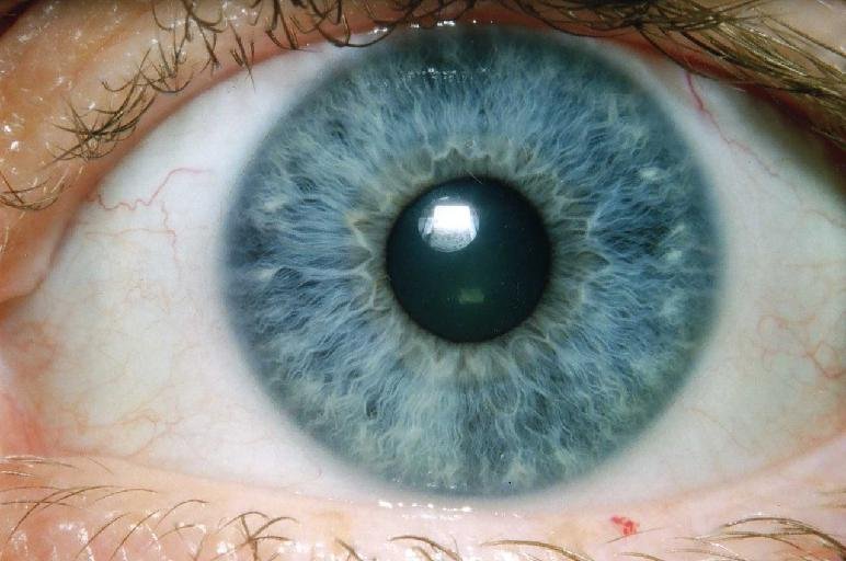iris image quality comparison different lighting conditions