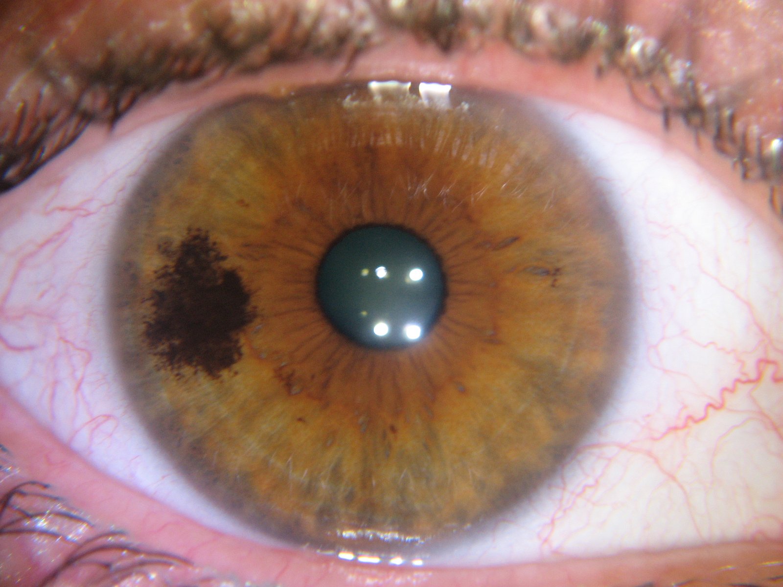 MAIKONG IRIDOLOGY CAMERA (2748)
