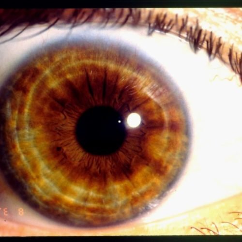 MAIKONG IRIDOLOGY