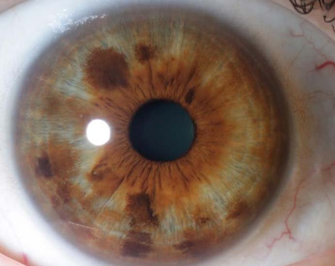 MAIKONG IRIDOLOGY CAMERA (2748)