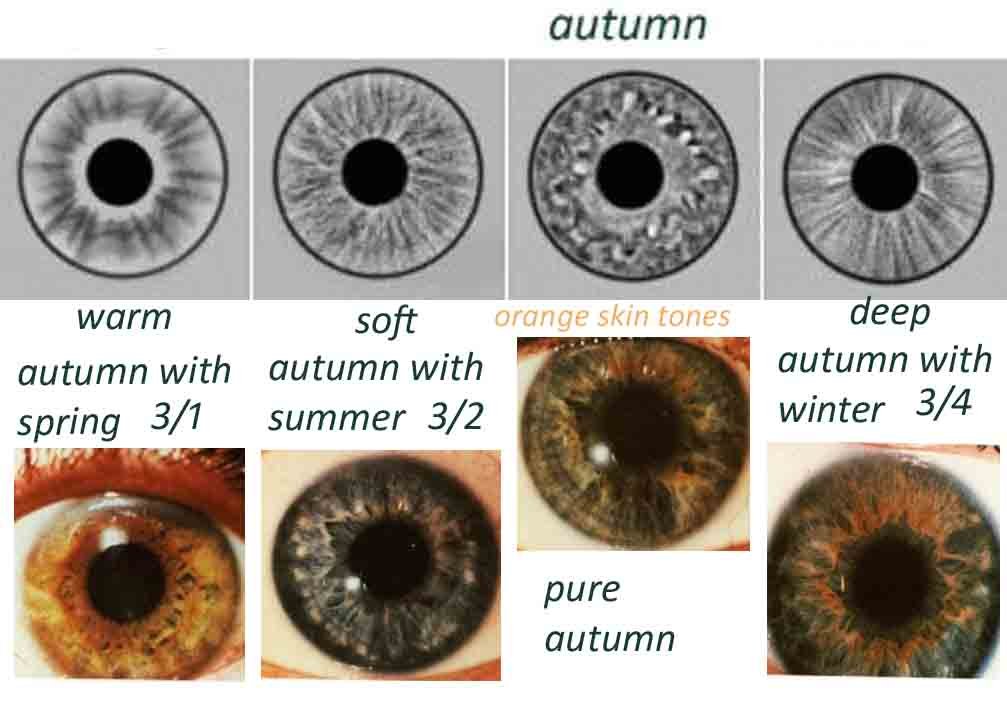 Digital portfolio of organized iridology case study images with annotations