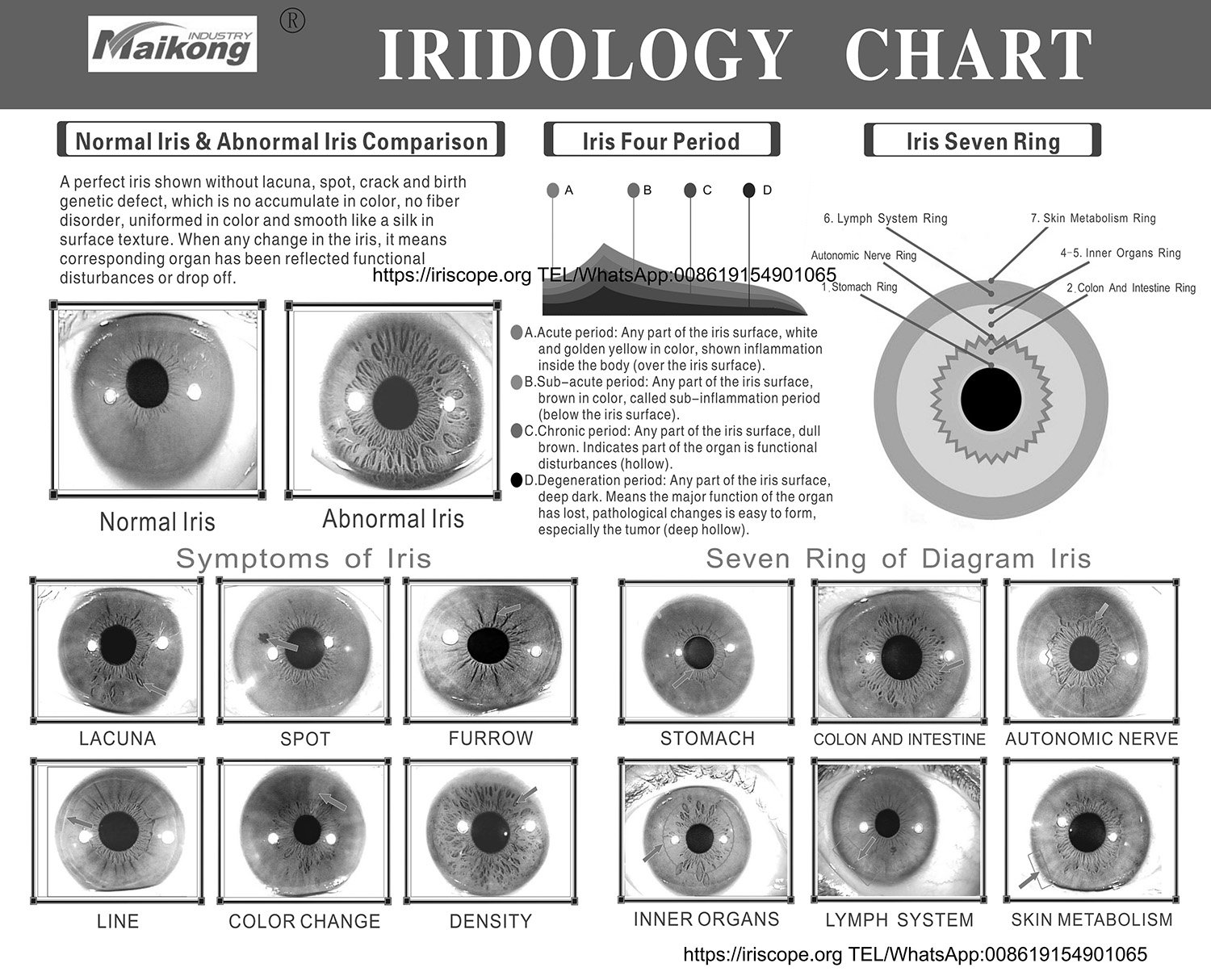 Screenshot of MAIKONG iridology software showing chart overlay on iris image