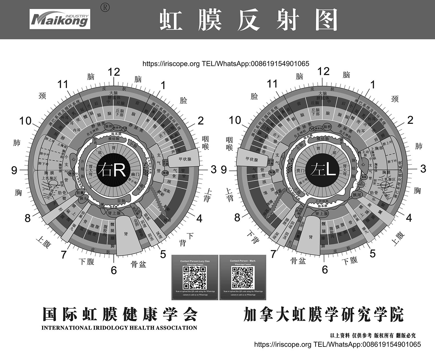 Iridology camera setup with high resolution chart displayed on computer monitor