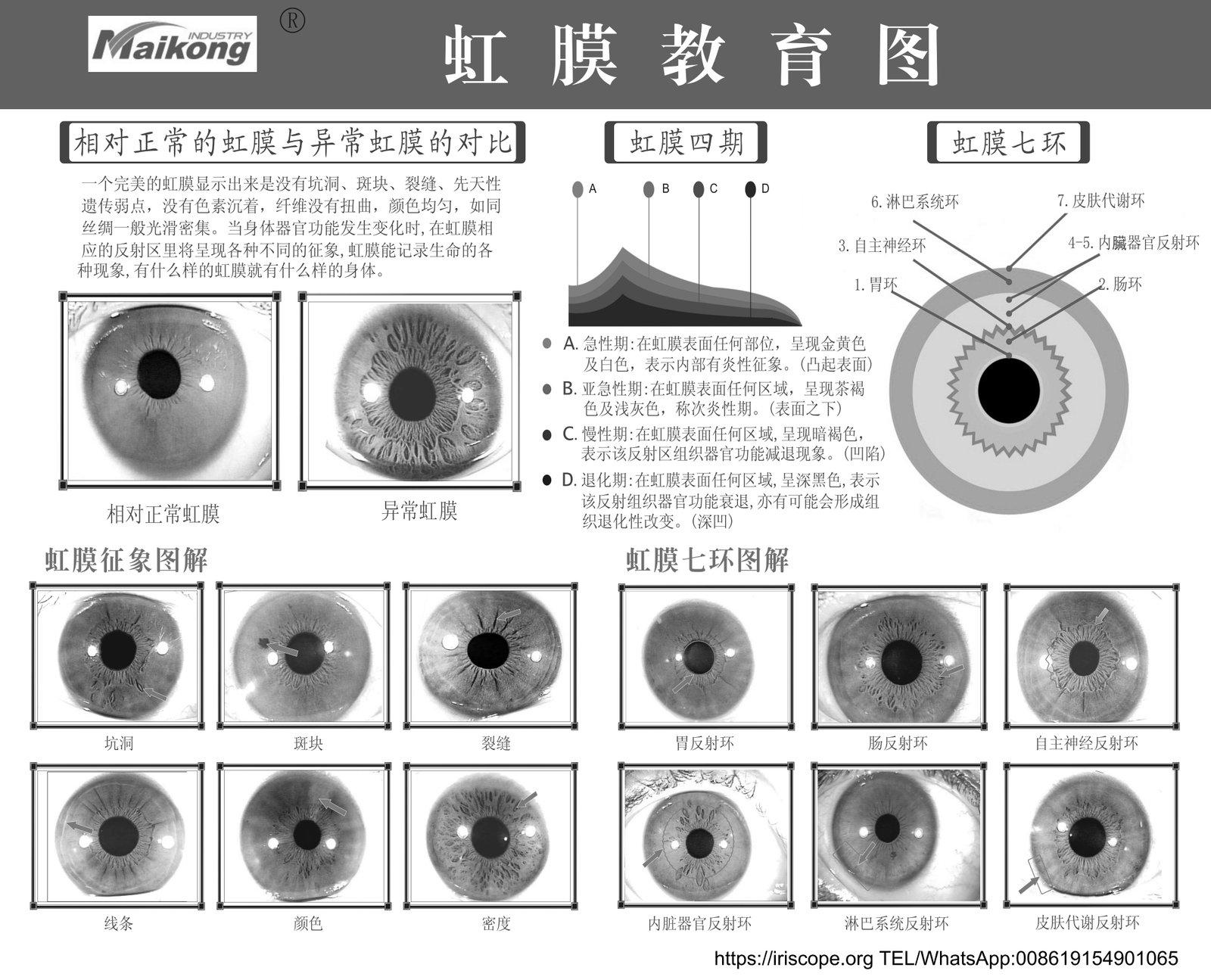 Iridology camera setup with high resolution chart displayed on computer monitor