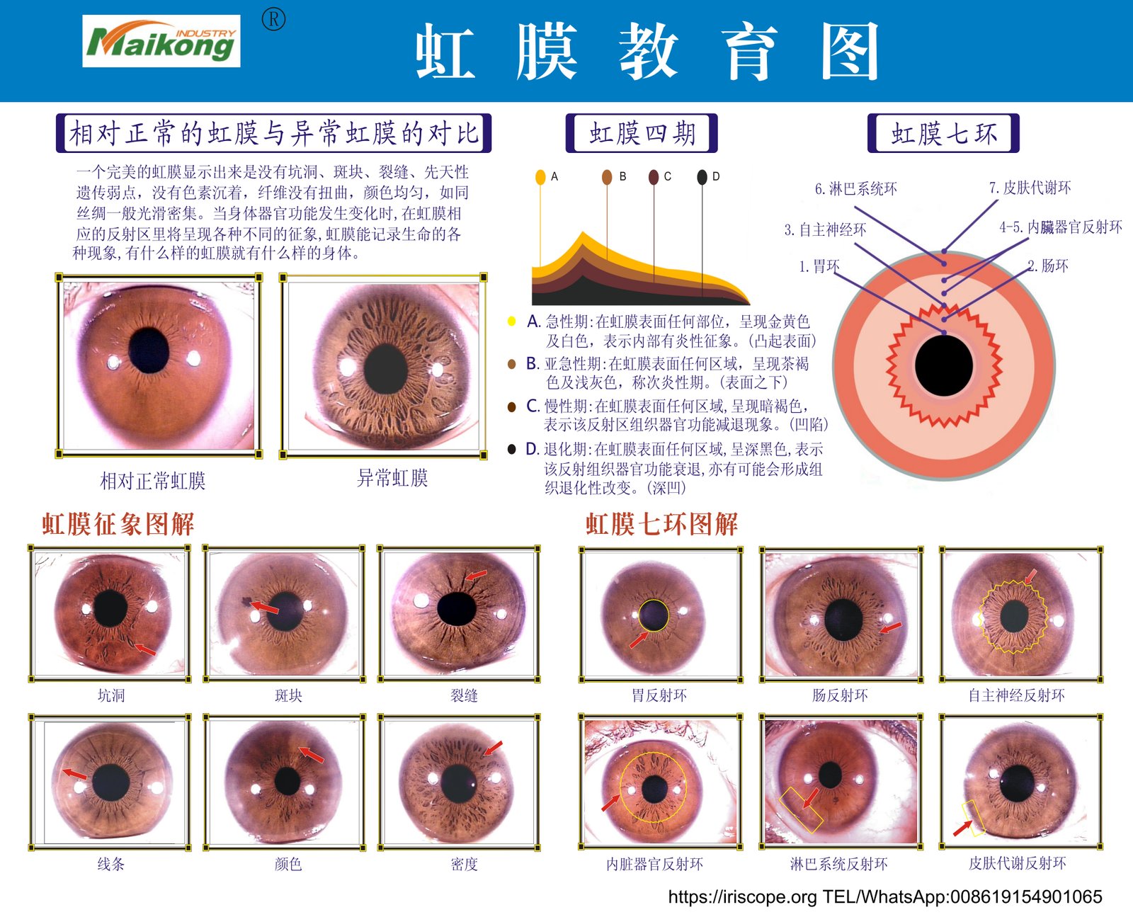Bernard Jensen iridology chart showing the classic American iridology mapping system