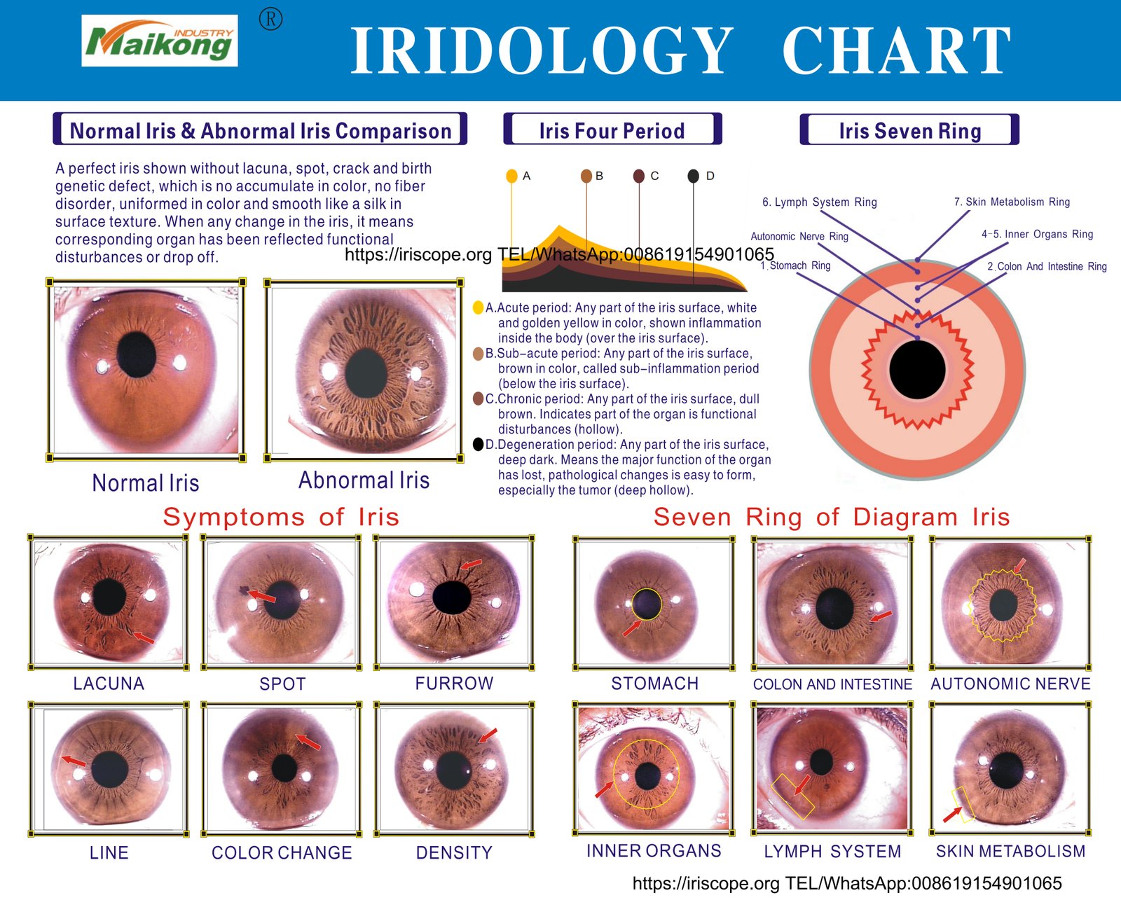 Historical iridology chart showing iris zones mapped to different body organs and systems