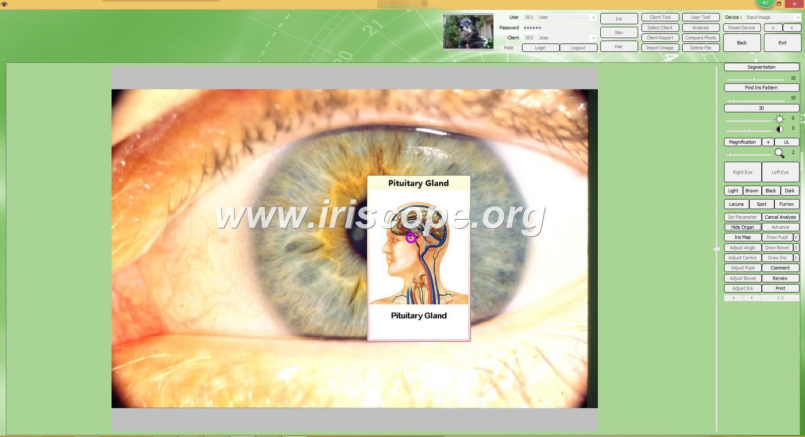 Iridology software client management database screen