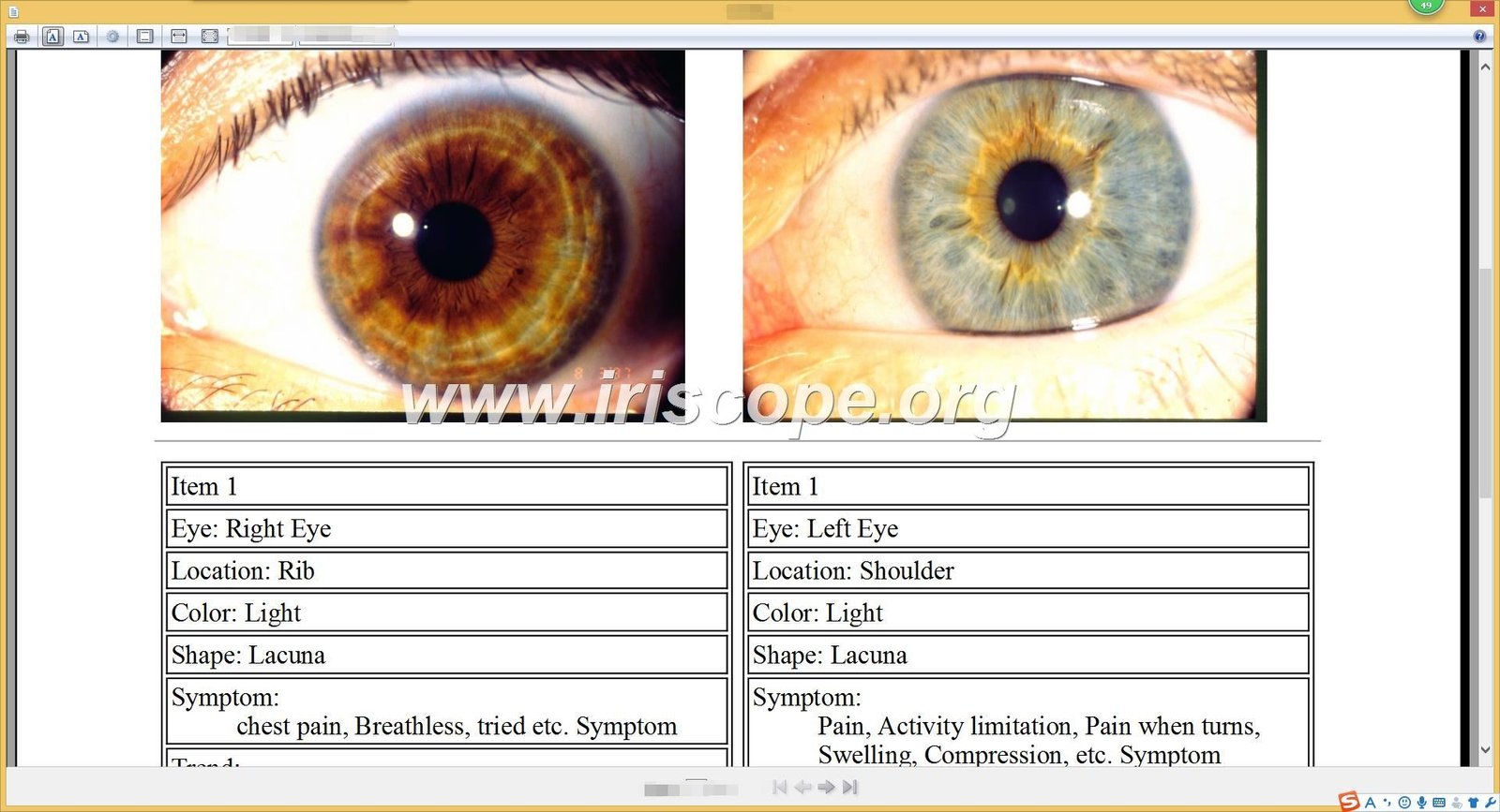 MAIKONG iridology software interface showing customizable branding areas and multi-language options