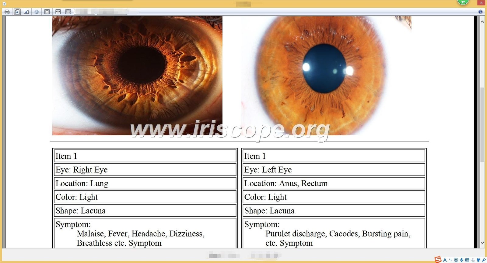 Screenshot of MAIKONG iridology software interface showing iris analysis features, client database, and report generation tools