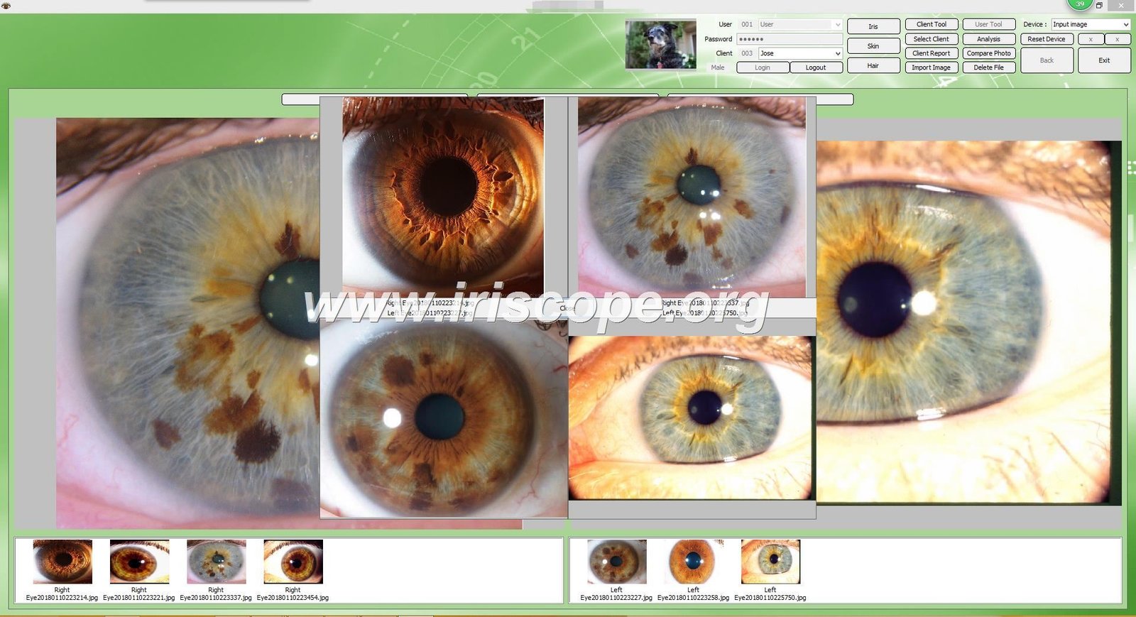 MAIKONG iridology software interface showing customizable branding areas and multi-language options