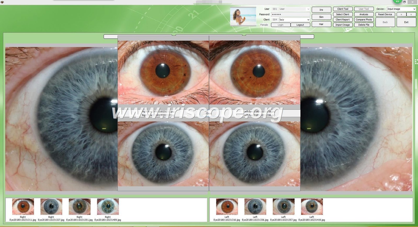 MAIKONG iridology software interface showing AI analysis results and iris image comparison