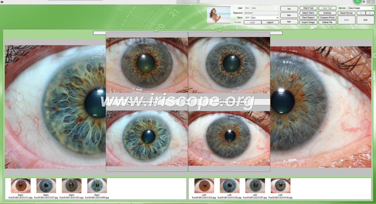 MAIKONG iridology software interface showing customizable branding areas and multi-language options