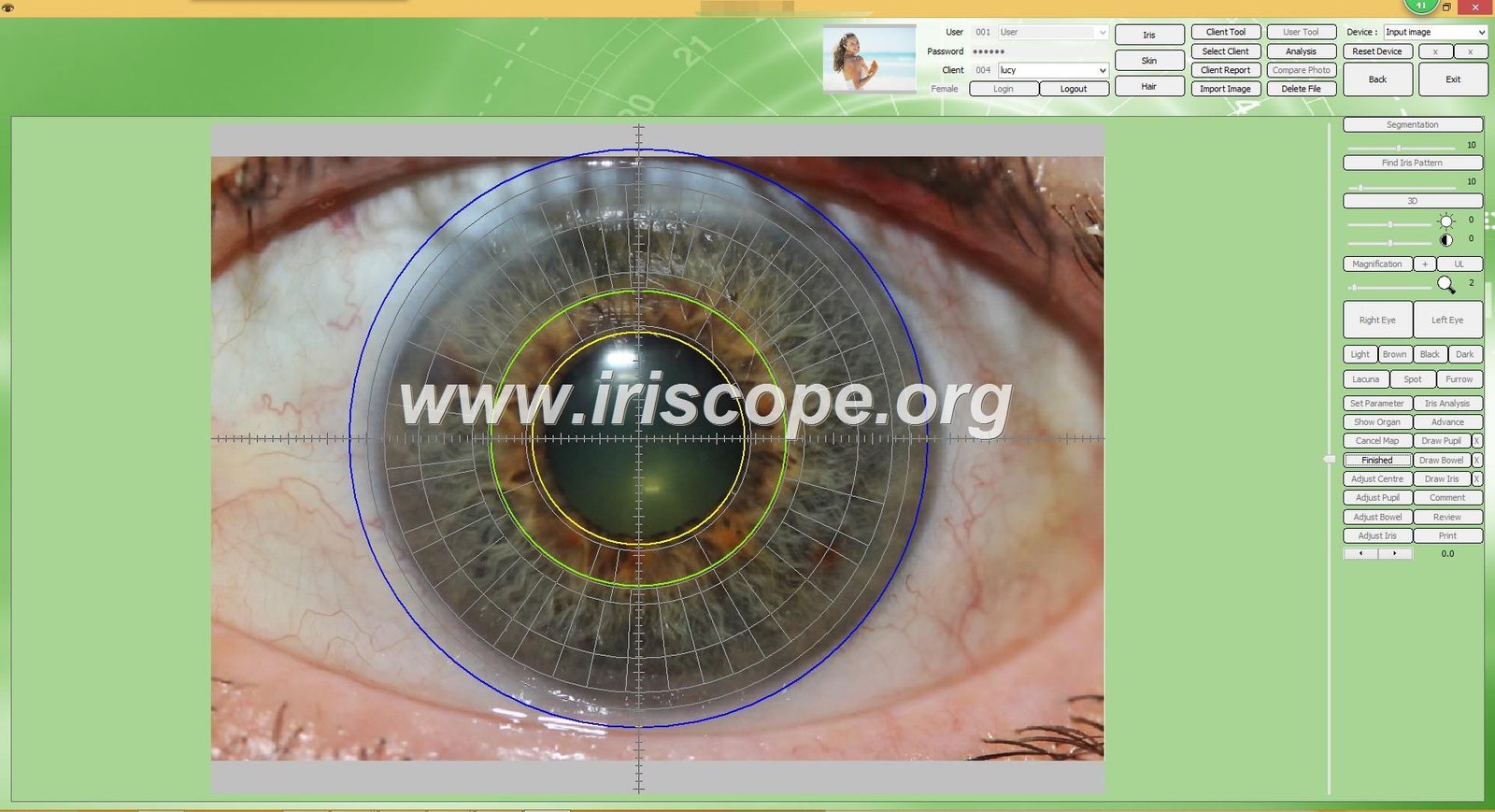 Custom branded iridology software interface showing white-label customization