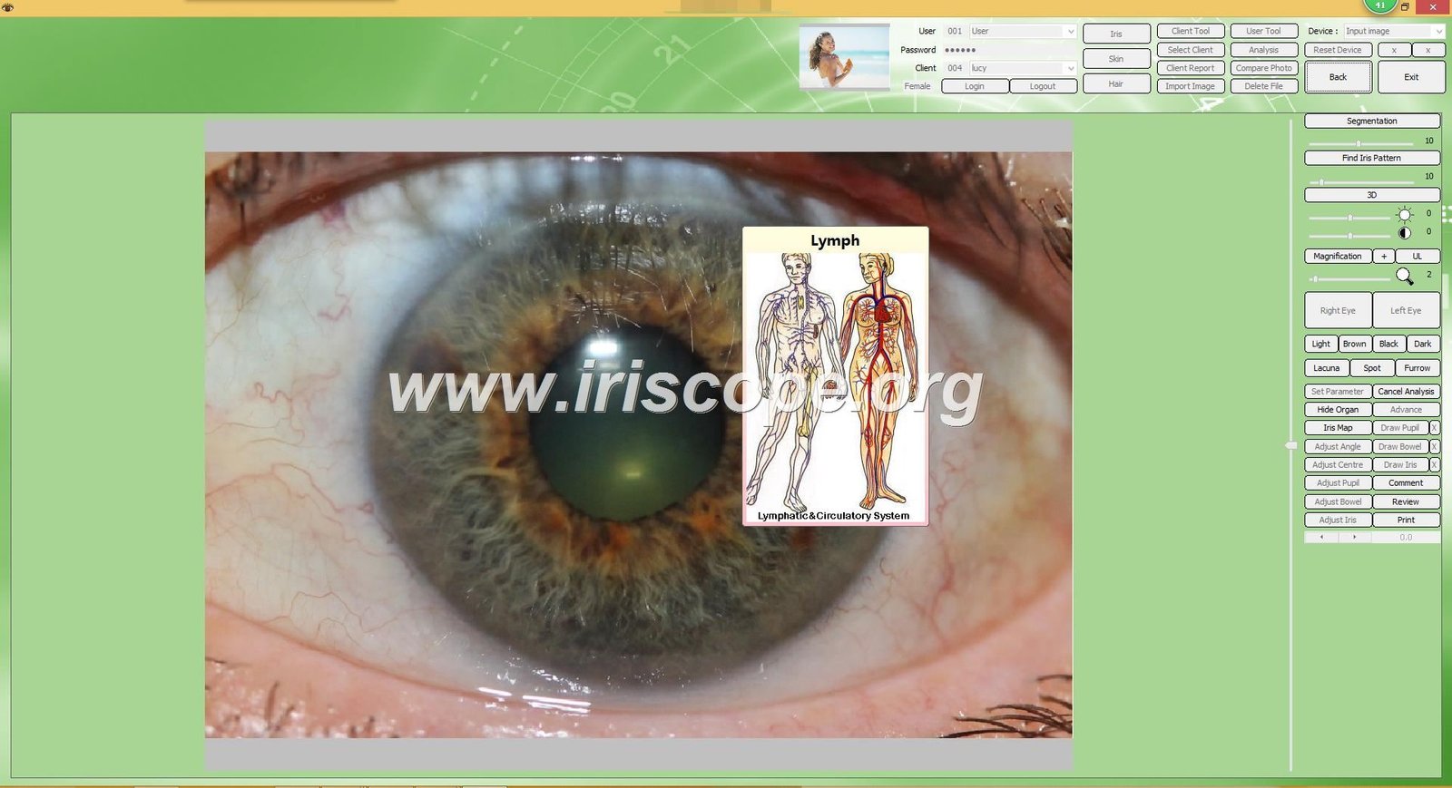 Iridology software client management database screen