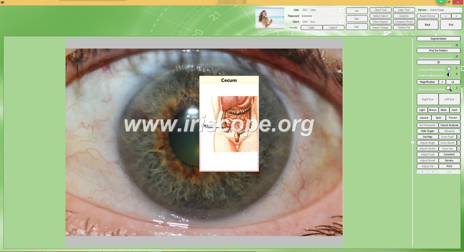 Iridology software client management database screen