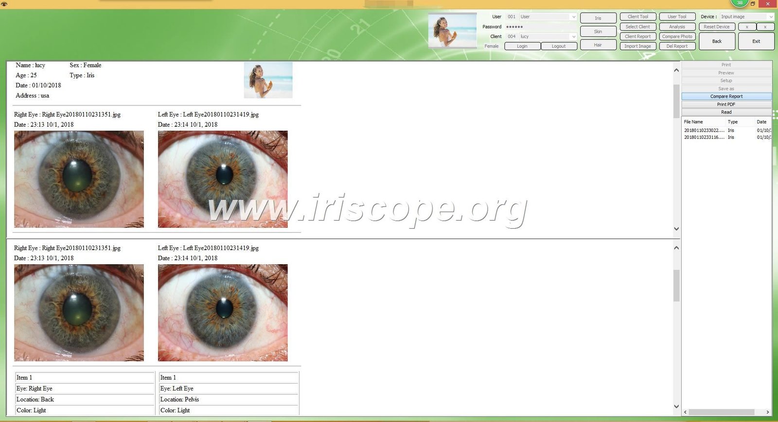 Iridology software report generation interface
