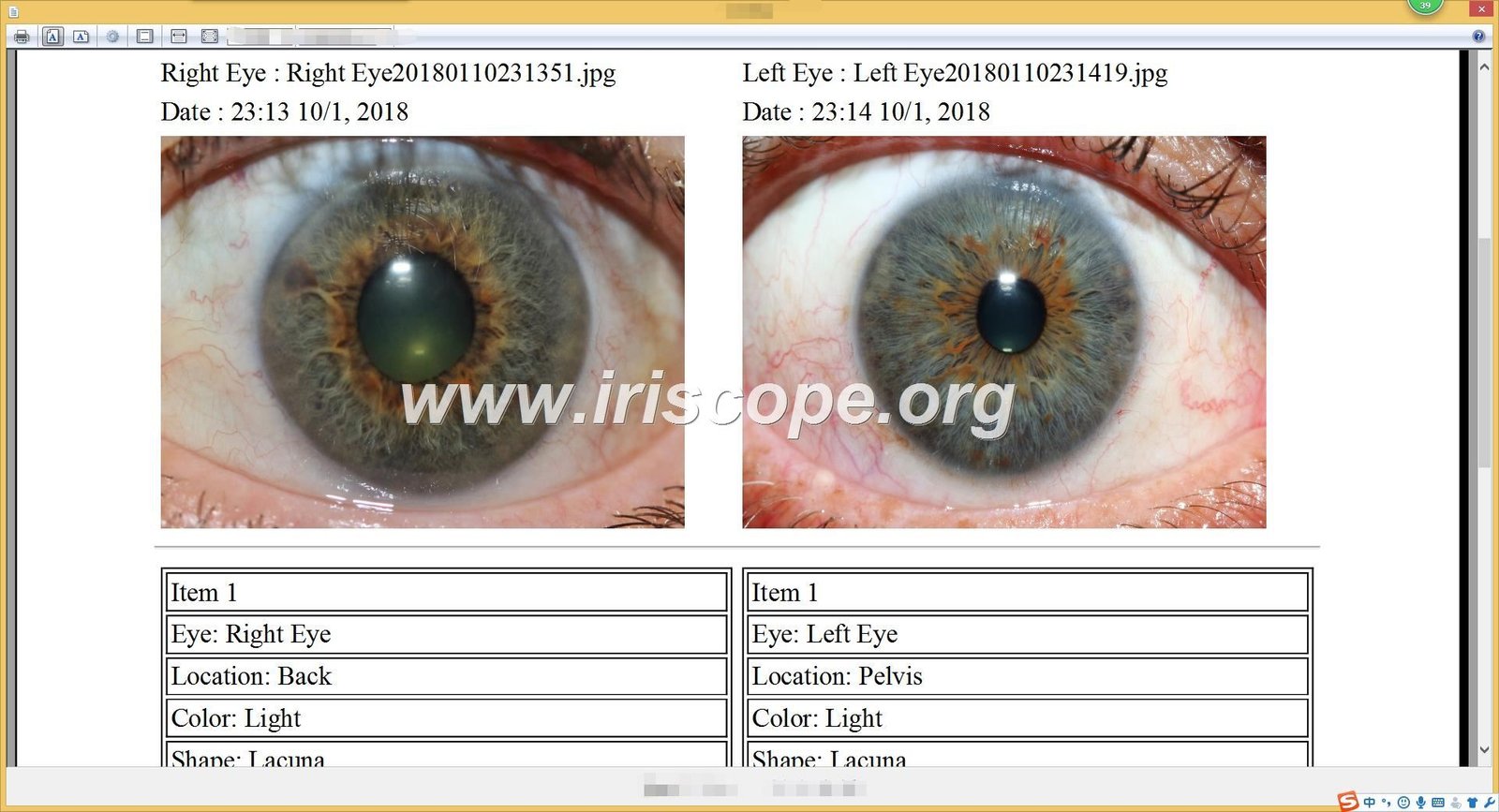 Product recommendation feature in iridology software