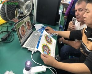Modern iridology software interface showing iris analysis tools