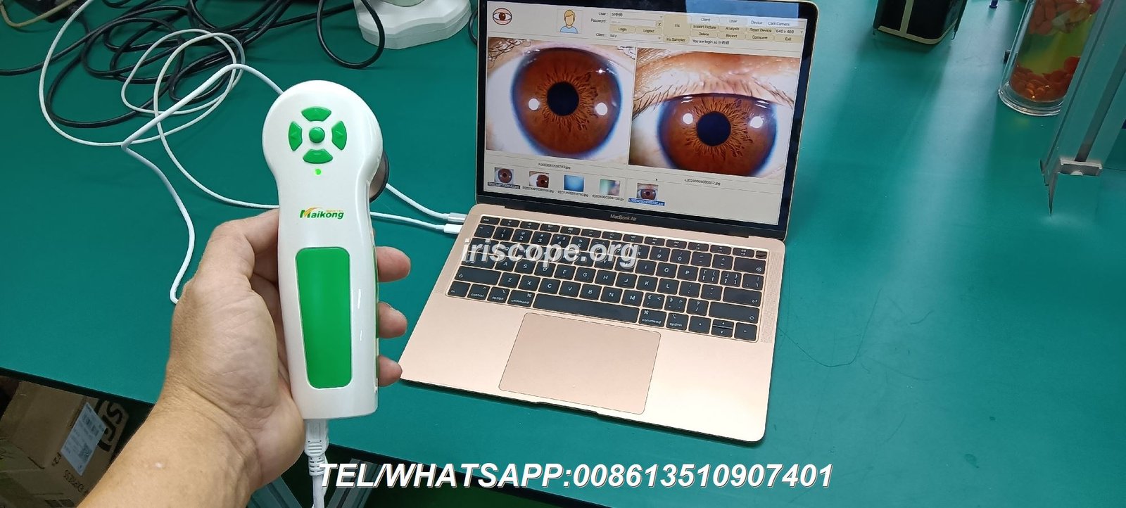 Iridologist in Putnam County NY 6 Iridology camera connected to computer with software