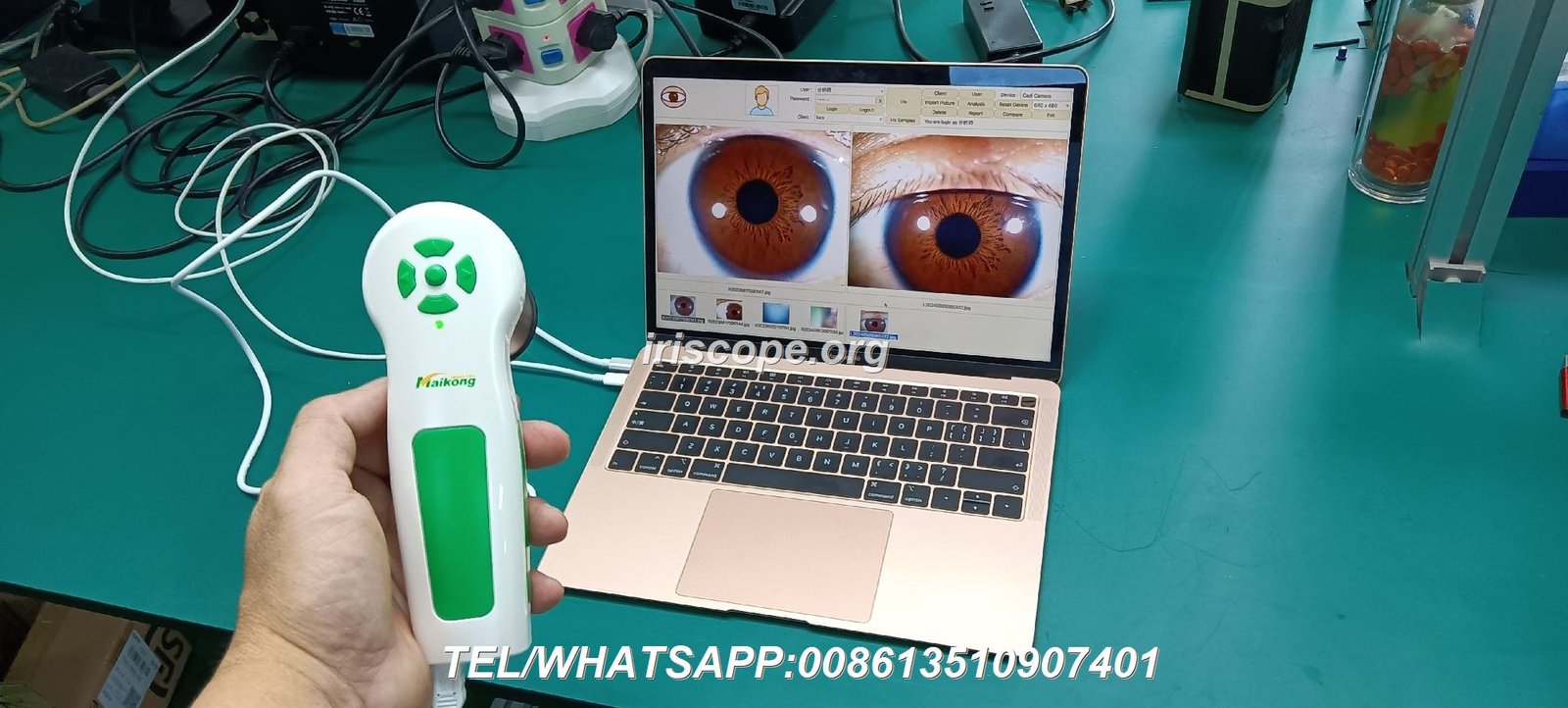 Digital iriscope analyzer displaying iris structure and patterns on computer screen