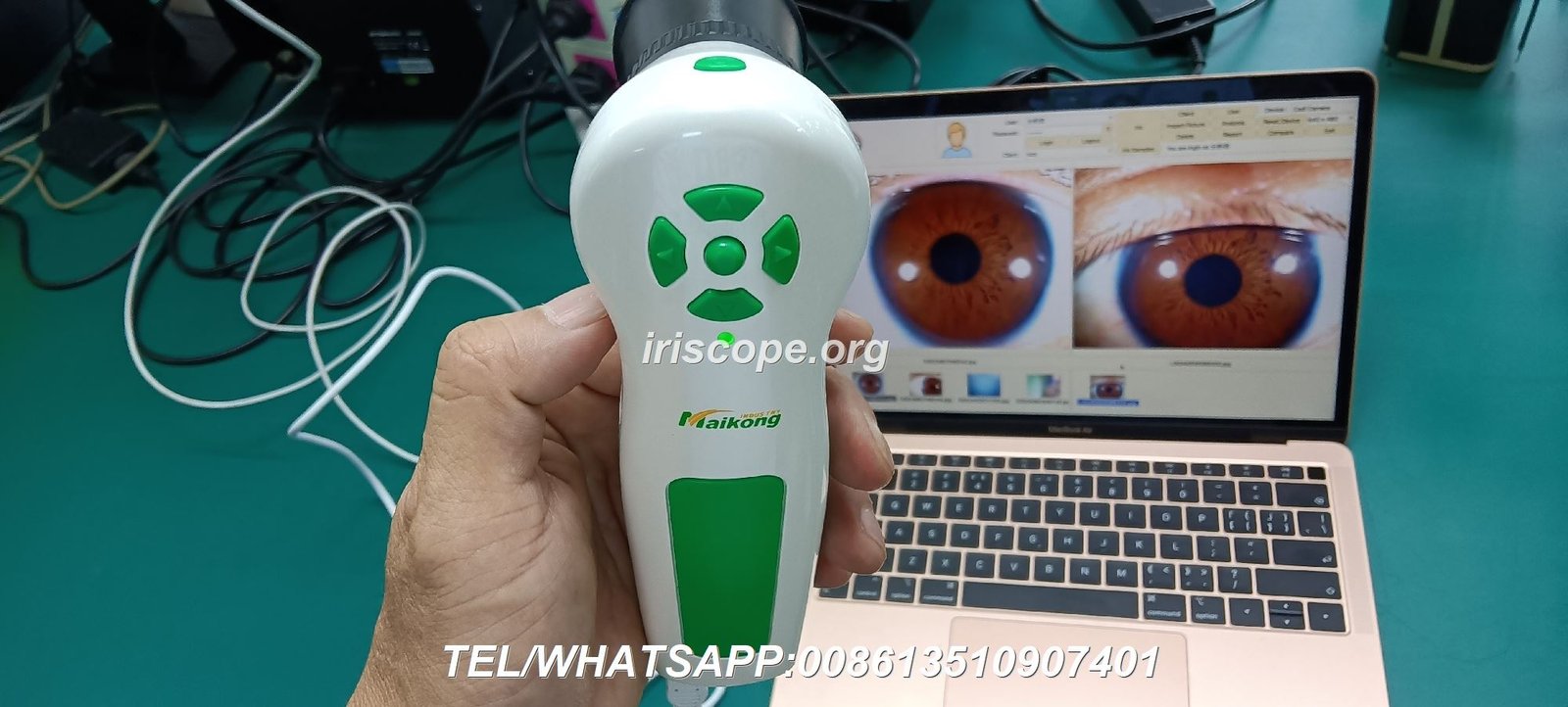Evolution of MAIKONG iridology cameras from 2004 to 2026
