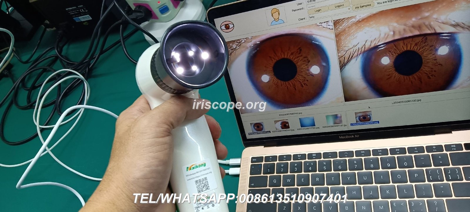 Evolution of MAIKONG iridology cameras from 2004 to 2026