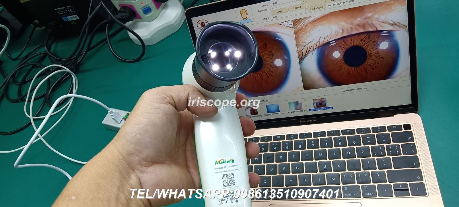 Evolution of MAIKONG iridology cameras from 2004 to 2026