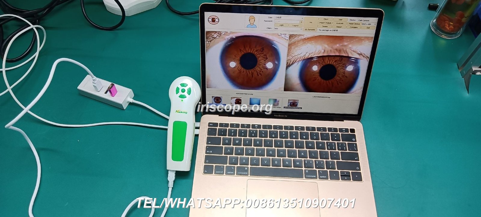 maikong 12 mp iridology camera for window 11 and apple mac os (77)