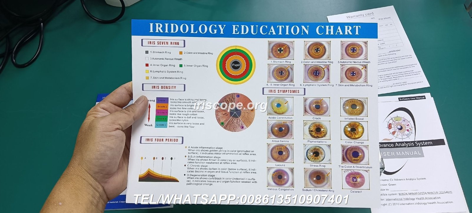 Three different iriscope models arranged by price tier showing entry, professional, and premium devices
