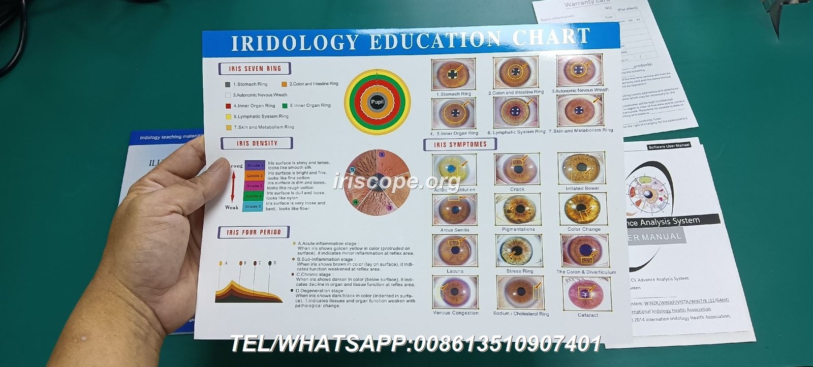 Nutrition counselor using iridology camera during consultation