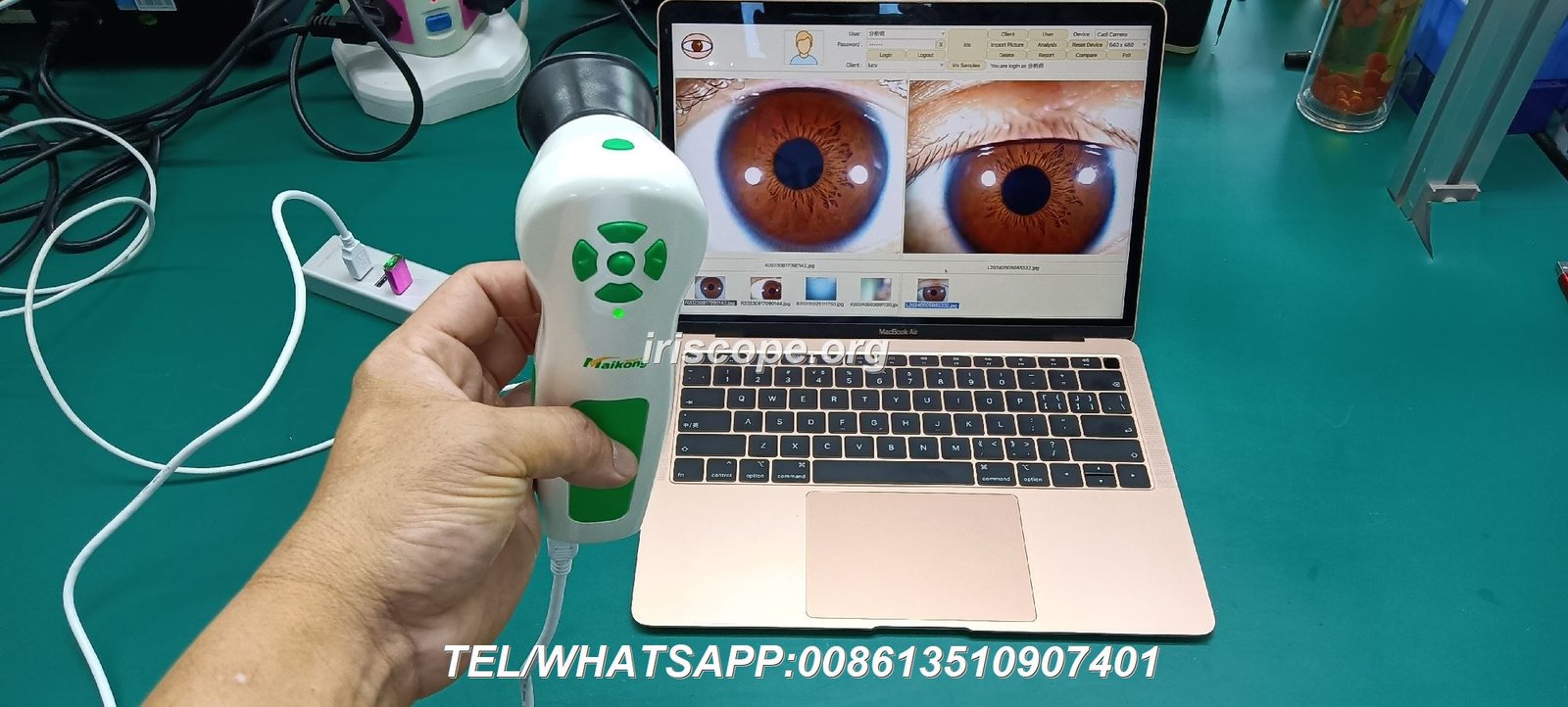 Iridology software running on MacBook Pro