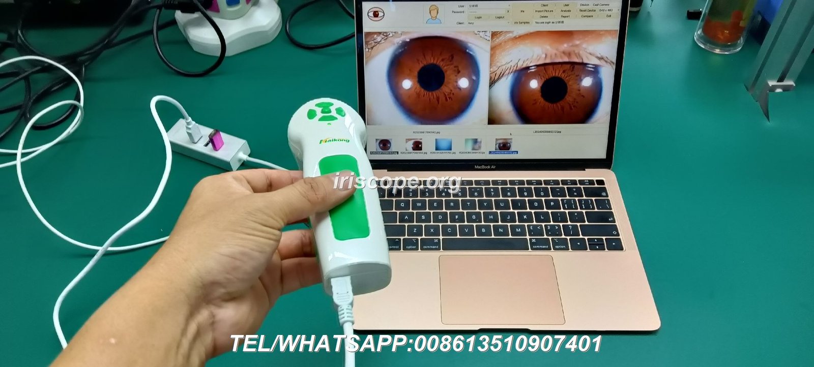 Iridology software running on MacBook Pro